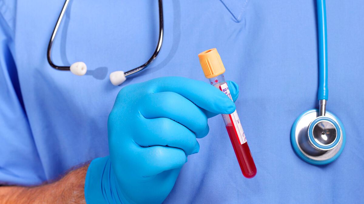 Doctor holding blood test sample