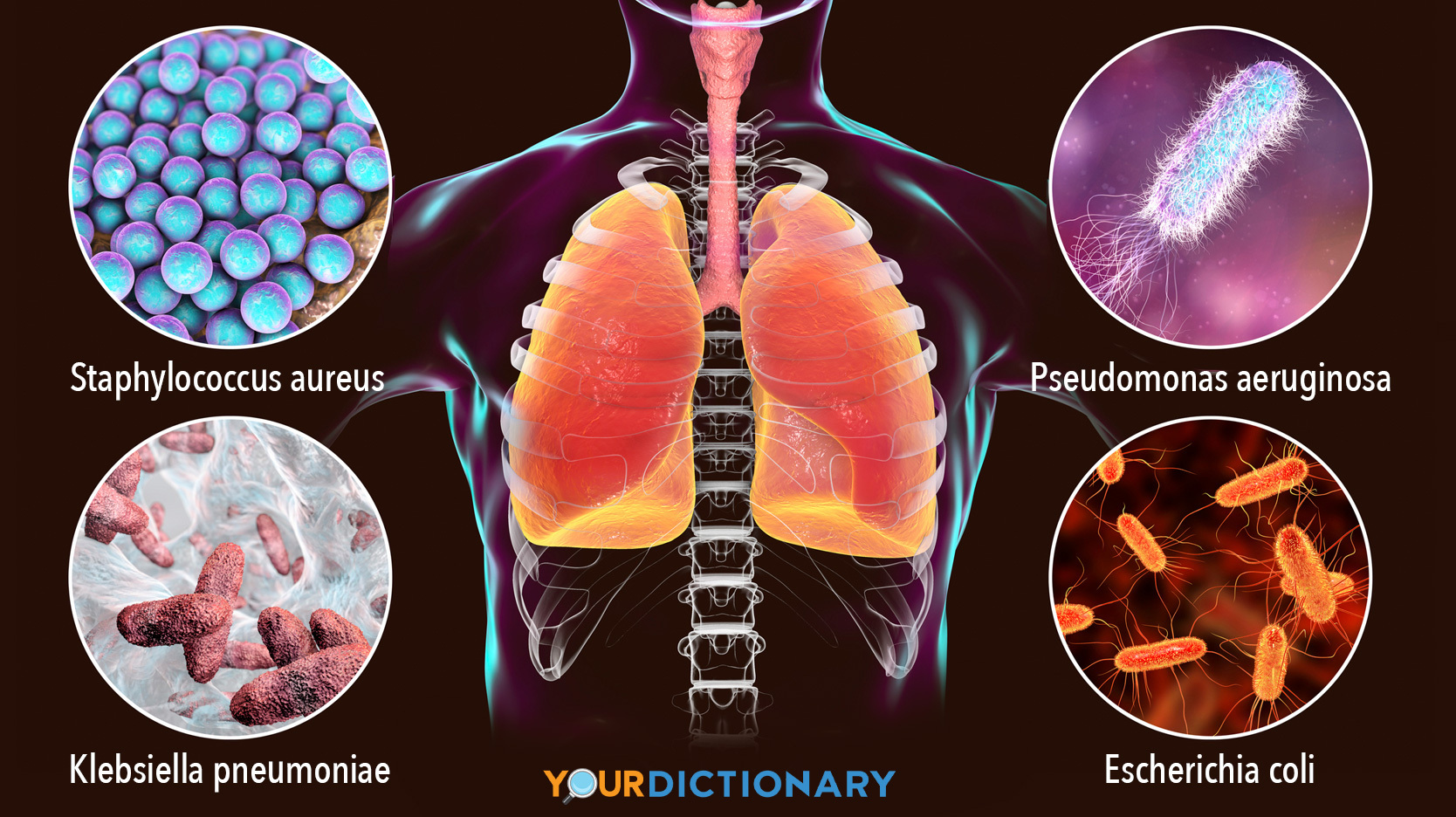 bacteria types that cause nosocomial pneumonia